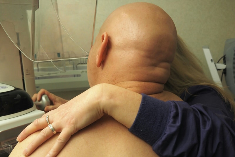 11-male-mammogram-mayo-clinic-arm-around-patient